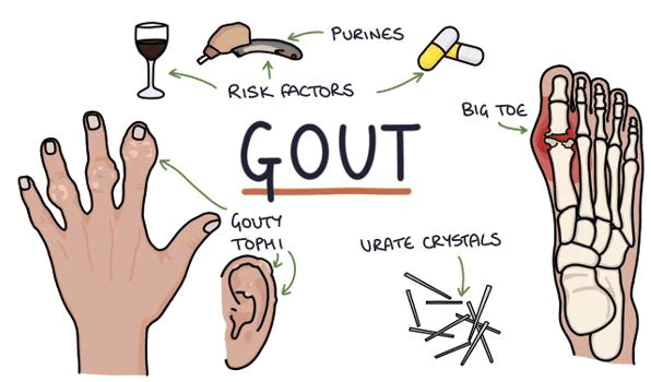 tspa-result tspa-result