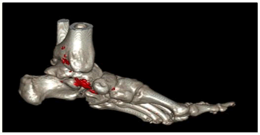 tspa-result tspa-result