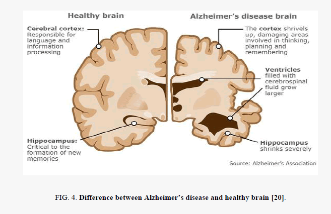 biochemistry-healthy-brain