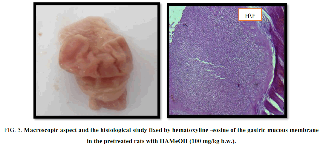 biotechnology-Macroscopic-eosine-gastric