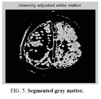 biotechnology-Segmented-gray-matter