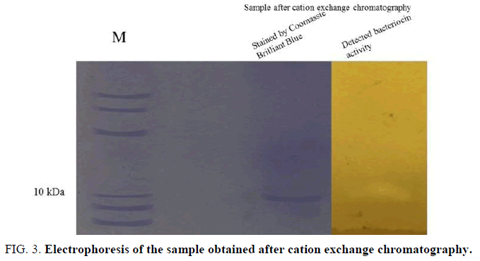 biotechnology-electrophoresis