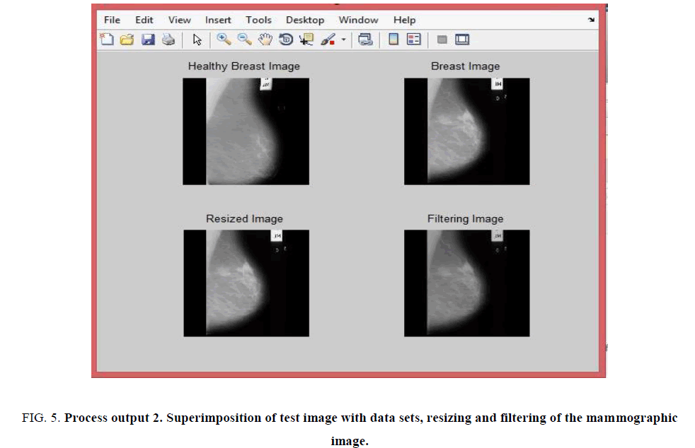 biotechnology-resizing-filtering-mammographic