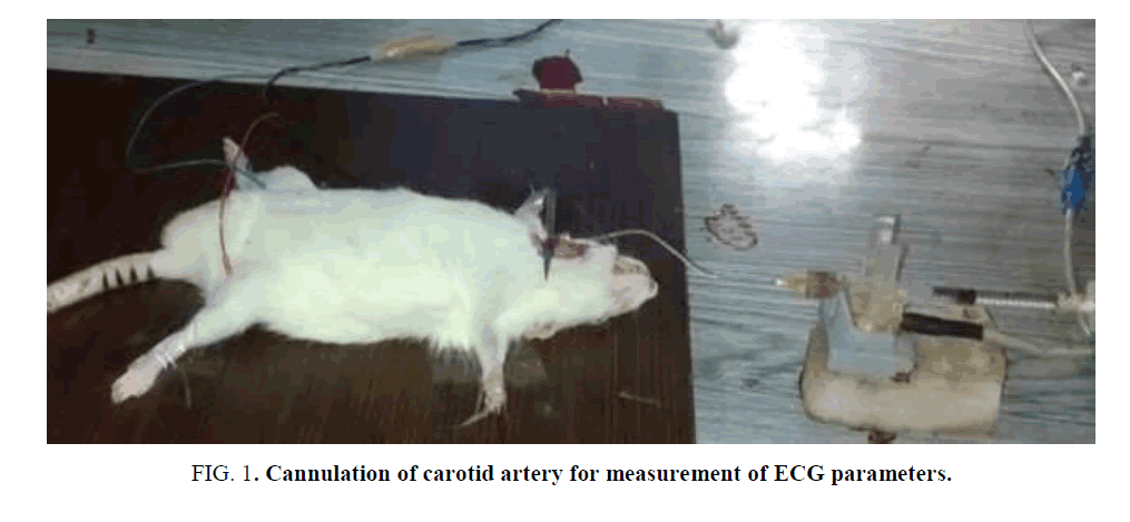 research-reviews-biosciences-ECG-parameters