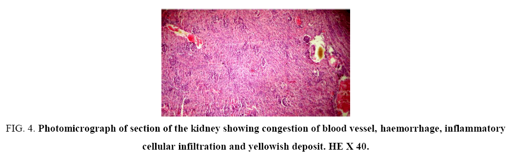 research-reviews-biosciences-kidney-congestion