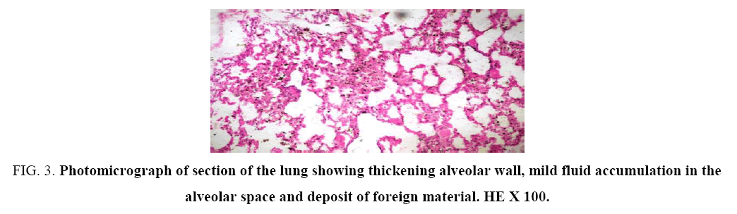 research-reviews-biosciences-thickening-alveolar